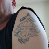 Perdaryti tatuiruotę