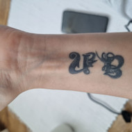 Tatuoruotės šalinimas