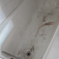 Vonios restauravimas